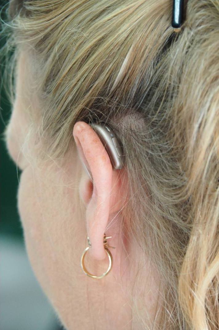 Woman with OTC hearing aid in ear